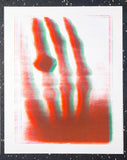 Röntgen + Bioplasma Handprint Diptych