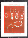 Röntgen + Bioplasma Handprint Diptych
