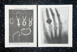 Röntgen + Bioplasma Handprint Diptych