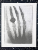 Röntgen + Bioplasma Handprint Diptych
